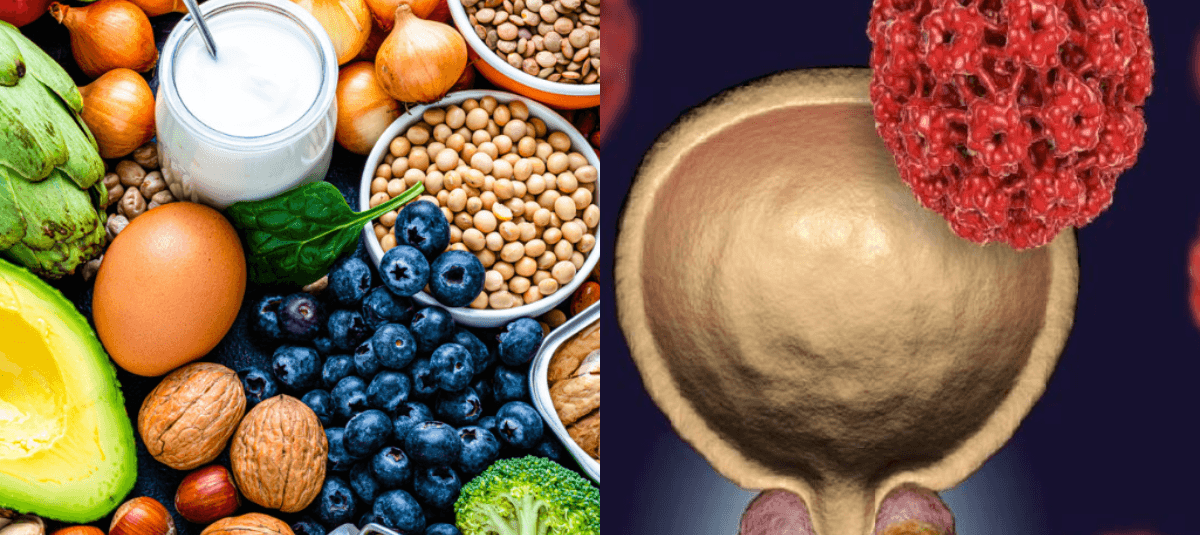 alimentos saludables para la prostata